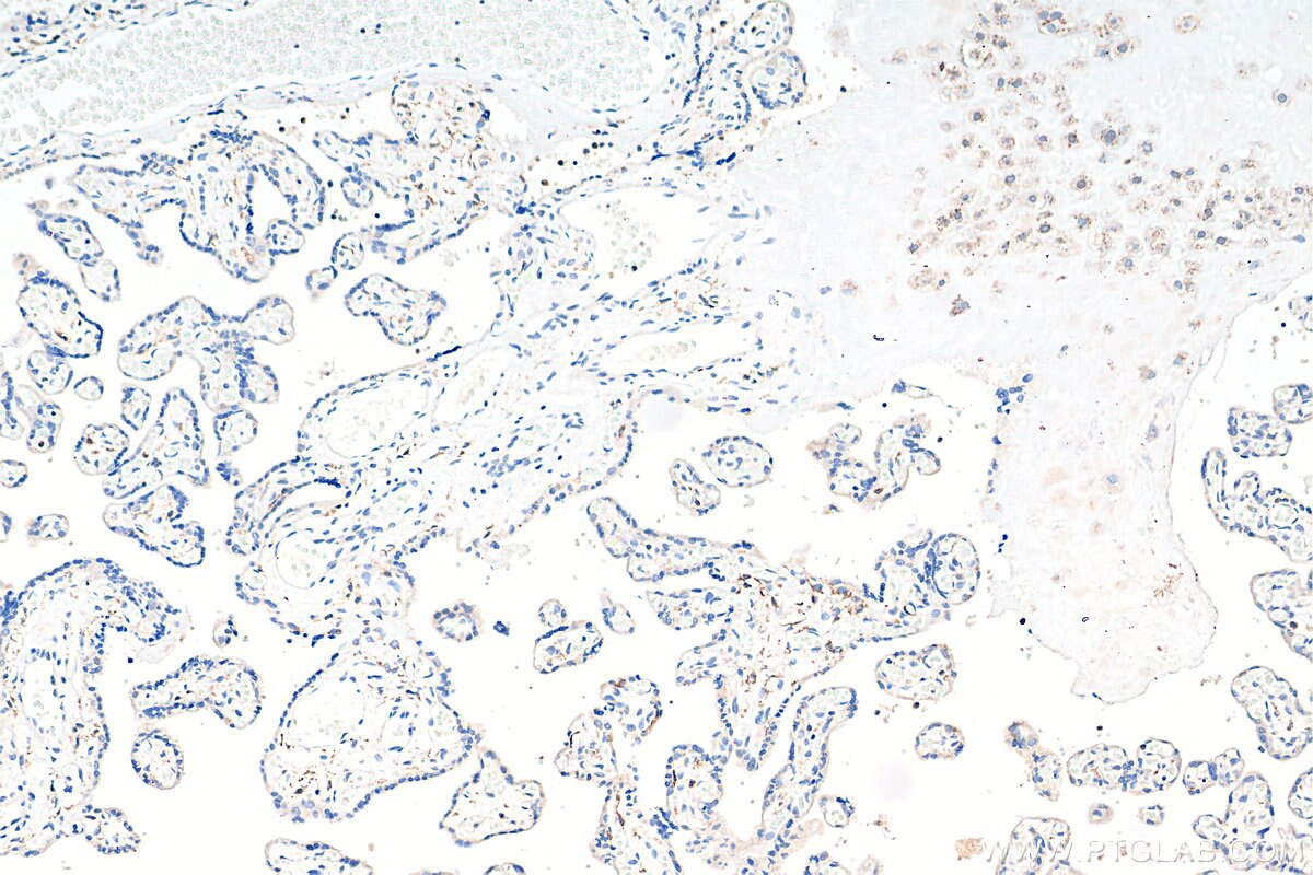 Immunohistochemistry (IHC) staining of human placenta tissue using CD206 Polyclonal antibody (18704-1-AP)