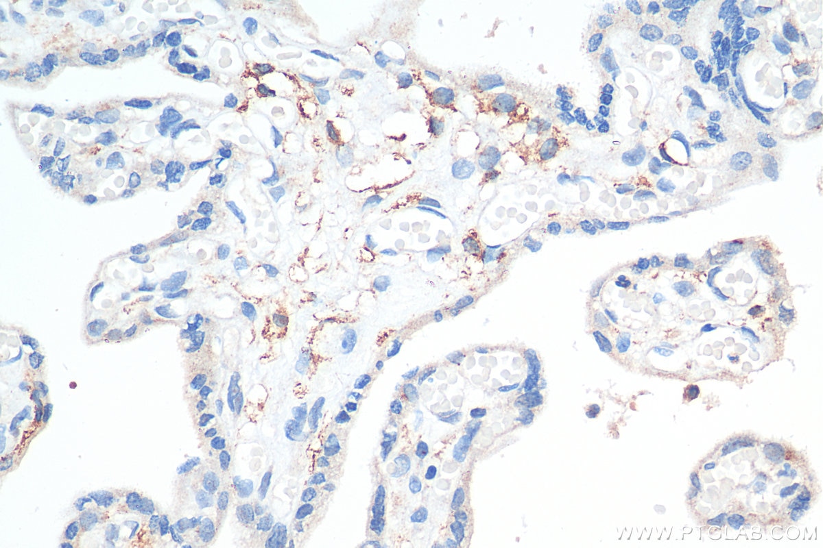 Immunohistochemistry (IHC) staining of human placenta tissue using CD206 Polyclonal antibody (18704-1-AP)