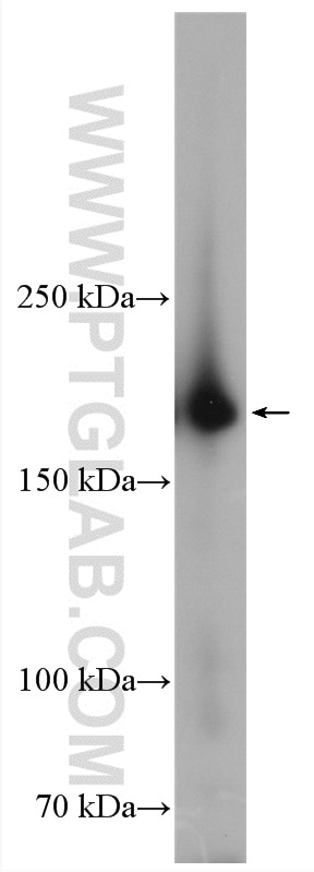Western Blot (WB) analysis of human placenta tissue using CD206 Polyclonal antibody (18704-1-AP)