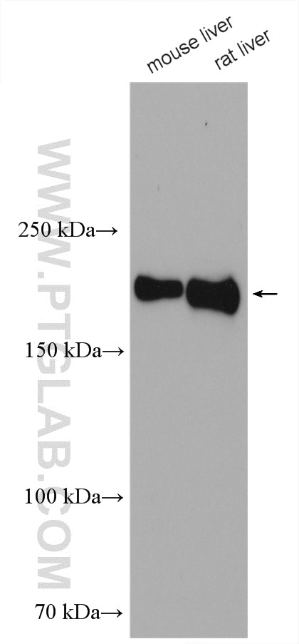 Western Blot (WB) analysis of various lysates using CD206 Polyclonal antibody (18704-1-AP)