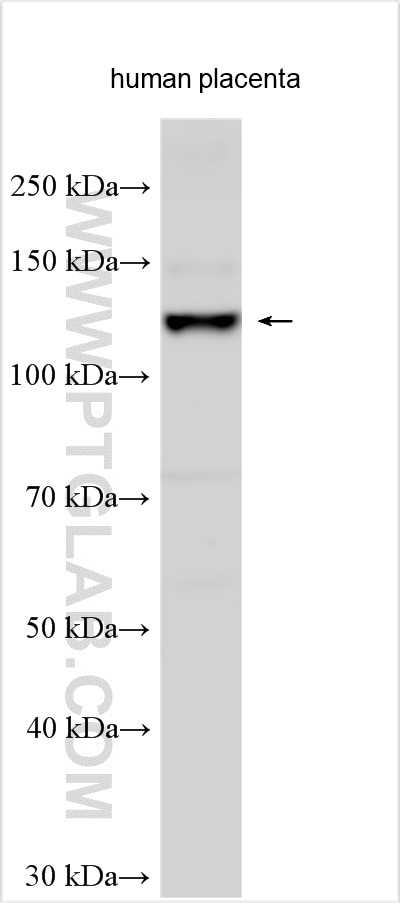 Western Blot (WB) analysis of various lysates using CD206 Polyclonal antibody (18704-1-AP)