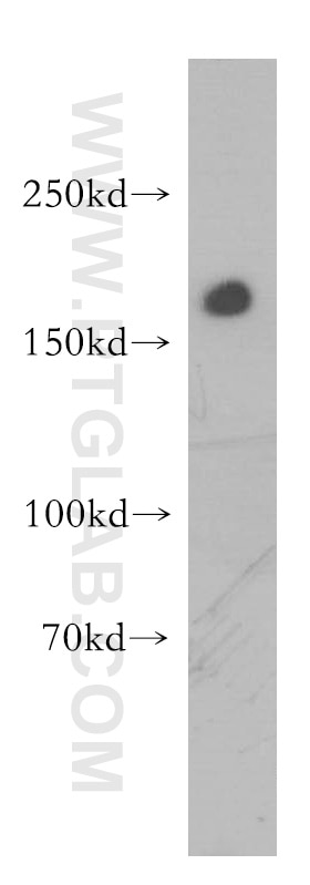 Western Blot (WB) analysis of human kidney tissue using CD206 Polyclonal antibody (18704-1-AP)