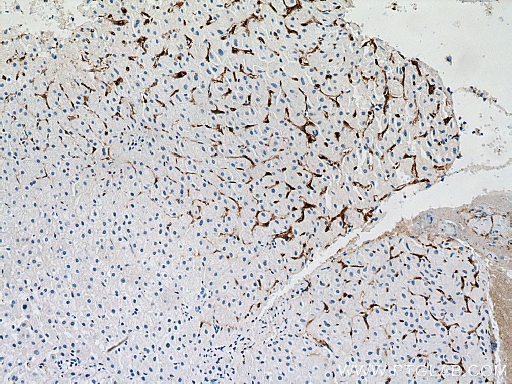 Immunohistochemistry (IHC) staining of human liver tissue using CD206 Monoclonal antibody (60143-1-Ig)