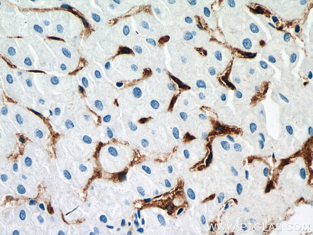 Immunohistochemistry (IHC) staining of human liver tissue using CD206 Monoclonal antibody (60143-1-Ig)