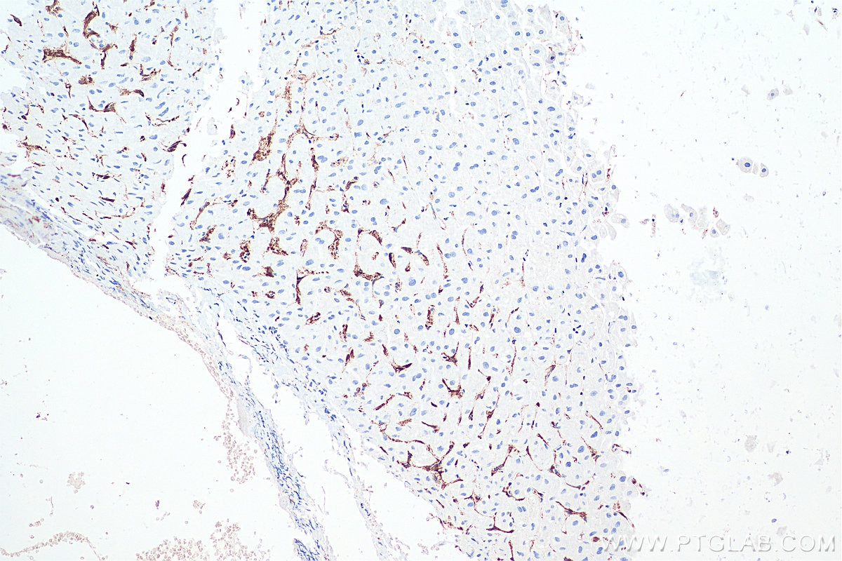 IHC staining of human liver using 60143-1-Ig Immunohistochemistry (IHC) staining of human liver tissue using CD206 Monoclonal antibody (60143-1-Ig)