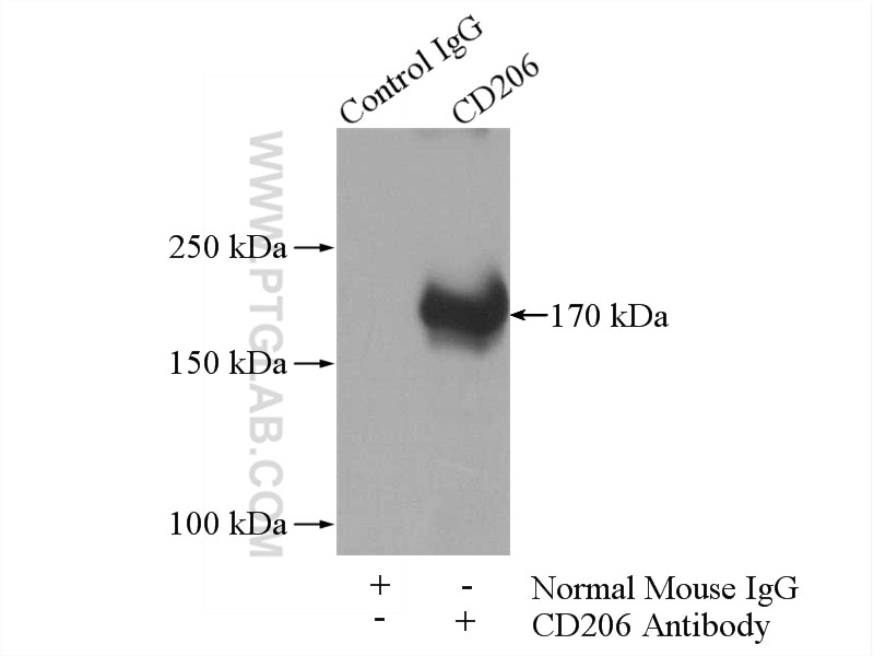 Immunoprecipitation (IP) experiment of human placenta tissue using CD206 Monoclonal antibody (60143-1-Ig)