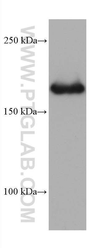 Western Blot (WB) analysis of human placenta tissue using CD206 Monoclonal antibody (60143-1-Ig)