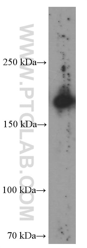 Western Blot (WB) analysis of human liver tissue using CD206 Monoclonal antibody (60143-1-Ig)