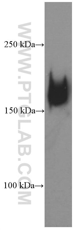 Western Blot (WB) analysis of human placenta tissue using CD206 Monoclonal antibody (60143-1-Ig)