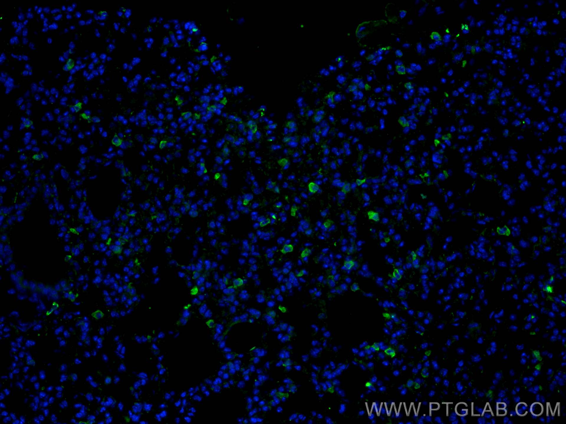 Immunofluorescence (IF) / fluorescent staining of mouse lung tissue using CD206 Recombinant antibody (81525-1-RR)