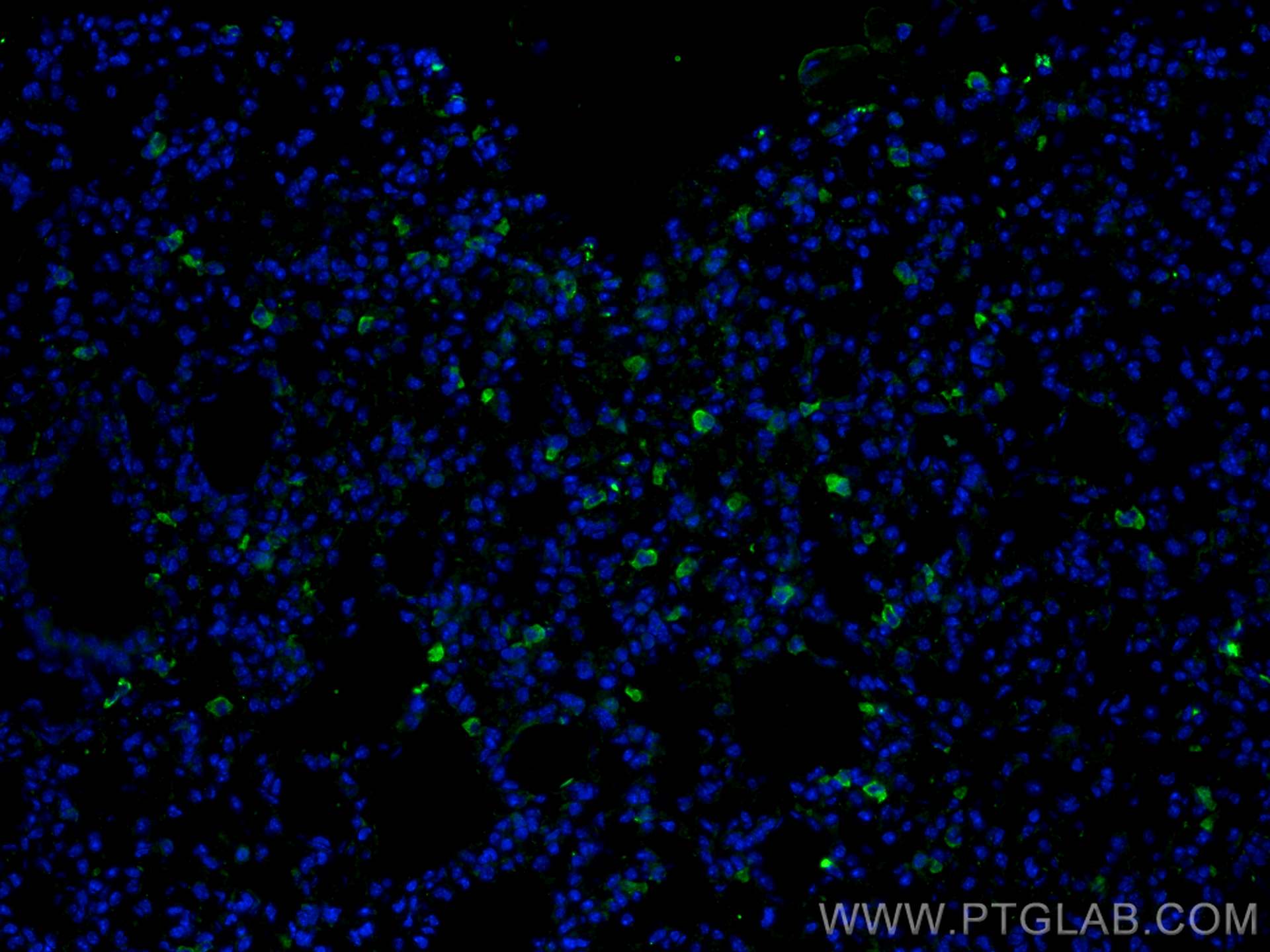 Immunofluorescence (IF) / fluorescent staining of mouse lung tissue using CD206 Recombinant antibody (81525-1-RR)