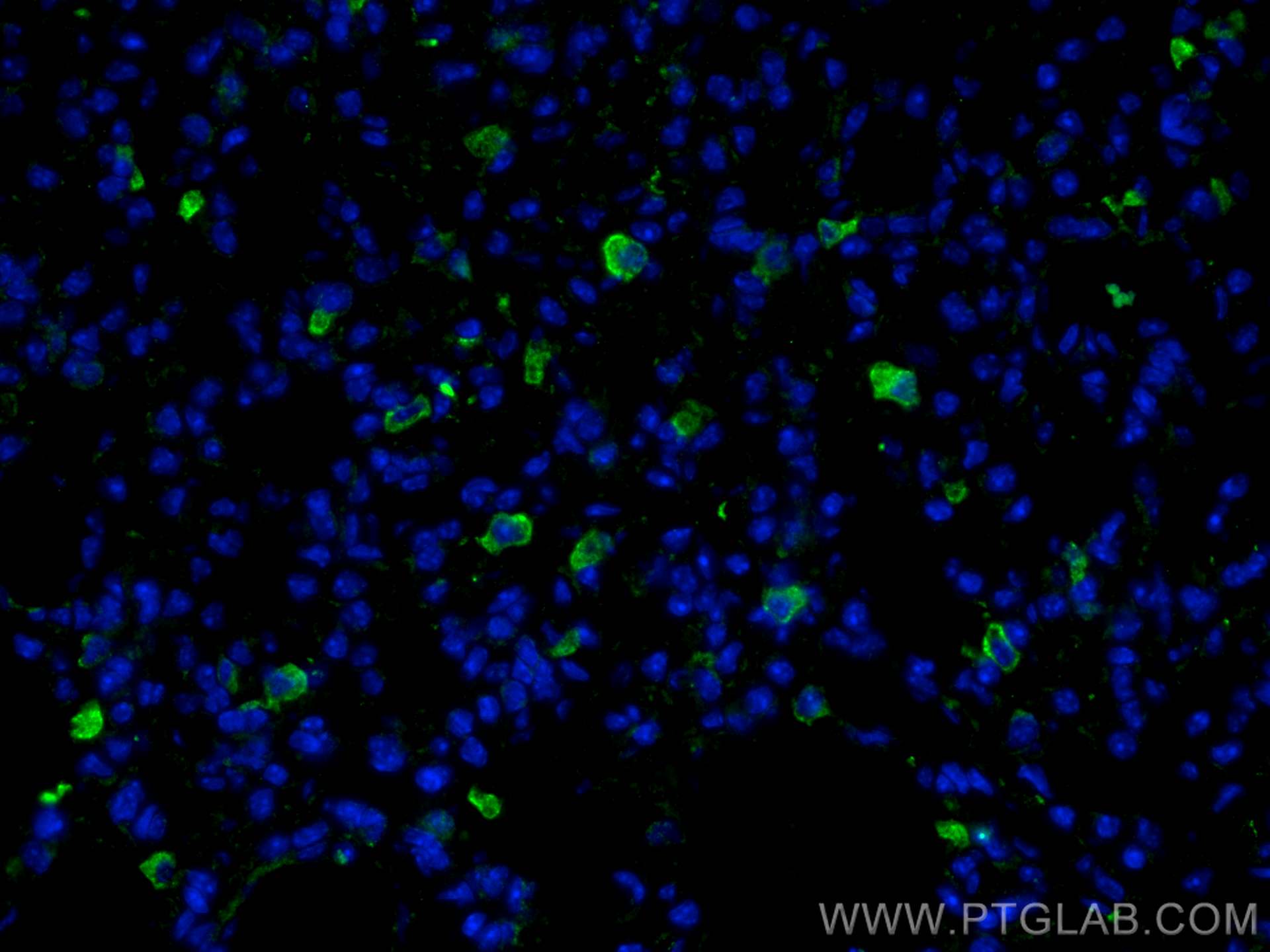 Immunofluorescence (IF) / fluorescent staining of mouse lung tissue using CD206 Recombinant antibody (81525-1-RR)
