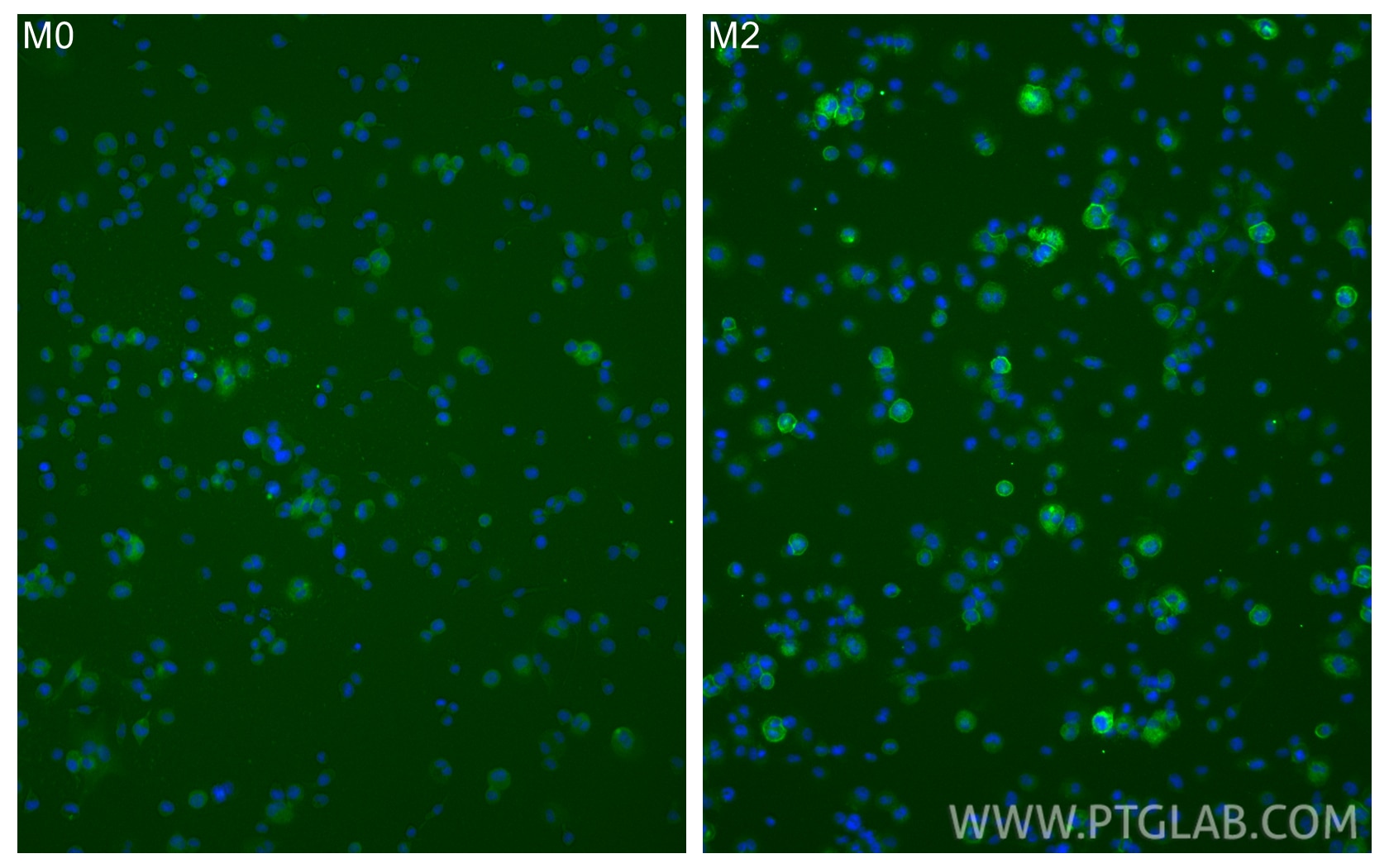Immunofluorescence (IF) / fluorescent staining of THP-1 cells using CD206 Recombinant monoclonal antibody (81525-1-RR)