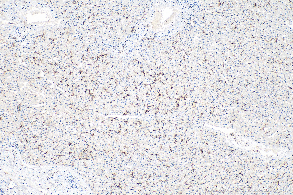 Immunohistochemistry (IHC) staining of human liver tissue using CD206 Recombinant monoclonal antibody (81525-1-RR)