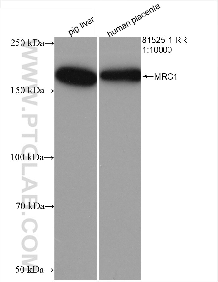 Western Blot (WB) analysis of various lysates using CD206 Recombinant antibody (81525-1-RR)