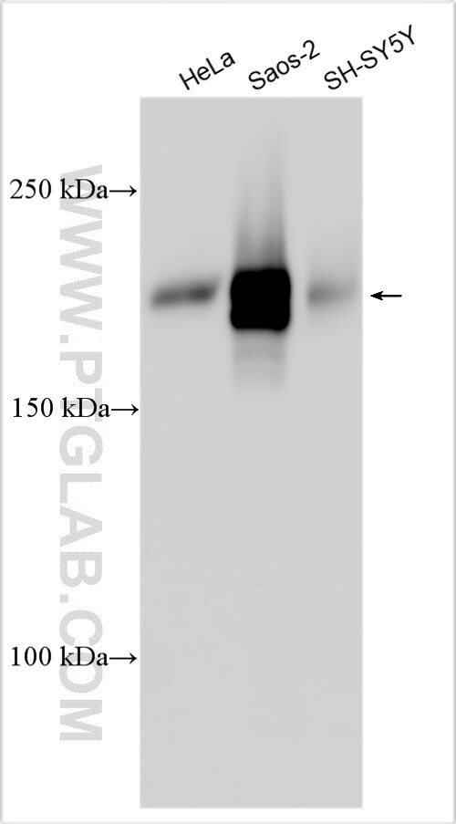 Western Blot (WB) analysis of various lysates using MRC2 Polyclonal antibody (21410-1-AP)