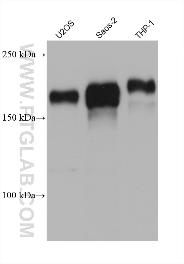 Various lysates were subjected to SDS PAGE followed by western blot with 60930-1-Ig (MRC2 antibody) at dilution of 1:5000 incubated at room temperature for 1.5 hours. Western Blot (WB) analysis of various lysates using MRC2 Monoclonal antibody (60930-1-Ig)