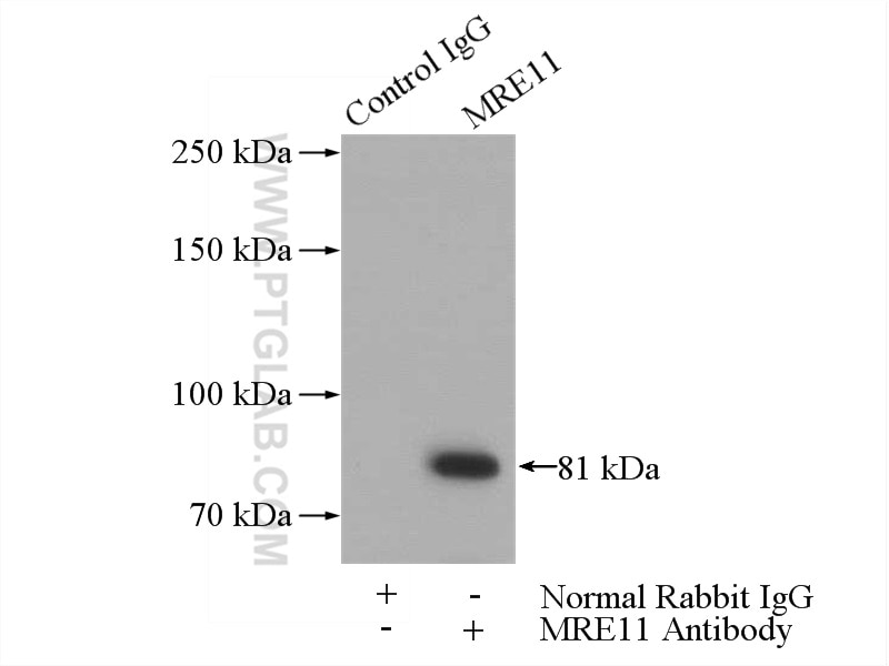 Immunoprecipitation (IP) experiment of HeLa cells using MRE11 Polyclonal antibody (10744-1-AP)