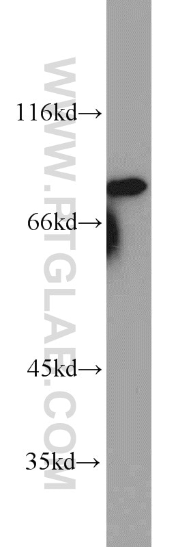 MRE11 Polyclonal antibody