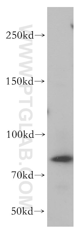 Western Blot (WB) analysis of HeLa cells using MRE11 Polyclonal antibody (10744-1-AP)