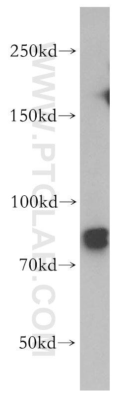 Western Blot (WB) analysis of Jurkat cells using MRE11 Polyclonal antibody (10744-1-AP)