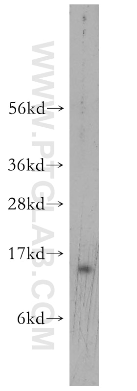 Western Blot (WB) analysis of Jurkat cells using MRFAP1 Polyclonal antibody (11639-1-AP)
