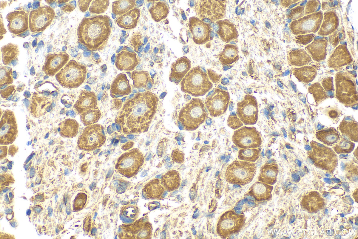 Immunohistochemistry (IHC) staining of rat dorsal root ganglion tissue using MRGPRD Polyclonal antibody (23640-1-AP)