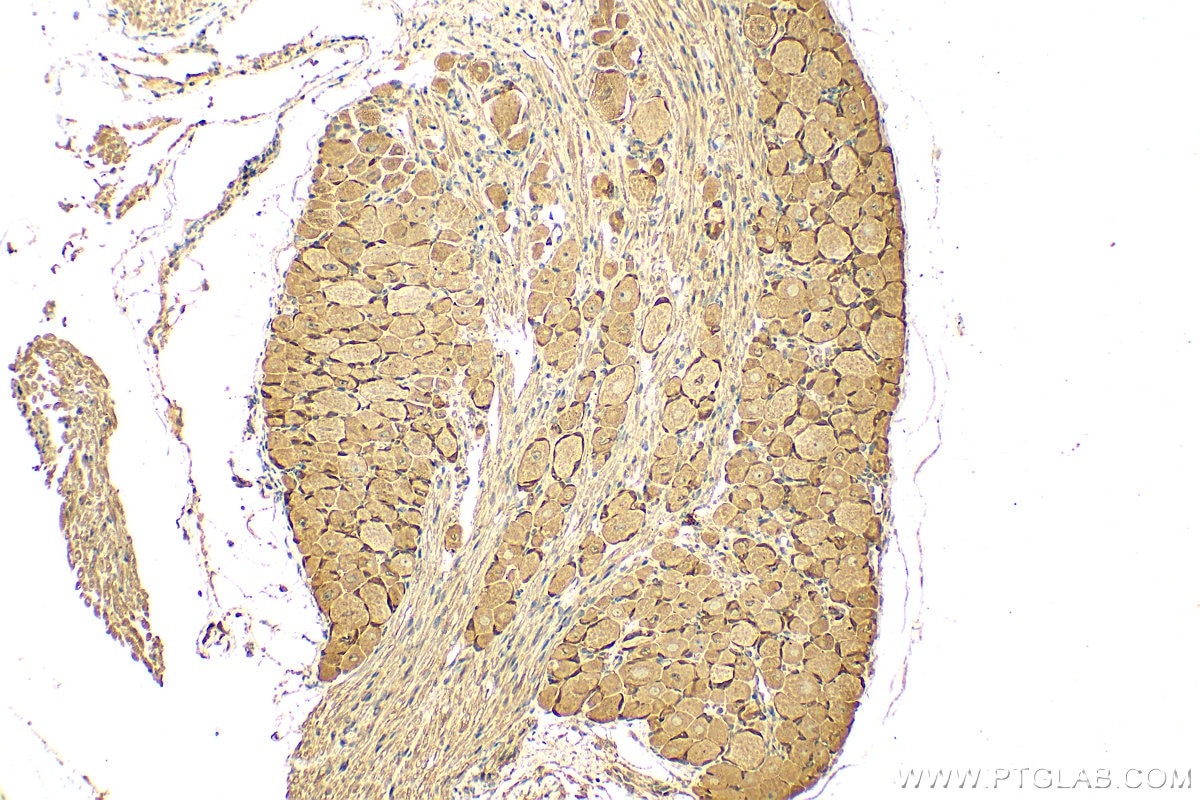 Immunohistochemistry (IHC) staining of rat dorsal root ganglion tissue using MRGPRE Polyclonal antibody (28080-1-AP)