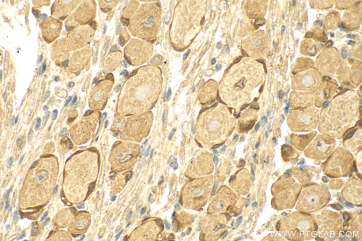 Immunohistochemistry (IHC) staining of rat dorsal root ganglion tissue using MRGPRE Polyclonal antibody (28080-1-AP)