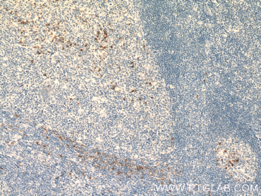 Immunohistochemistry (IHC) staining of human tonsillitis tissue using MRGPRX2 Polyclonal antibody (22375-1-AP)