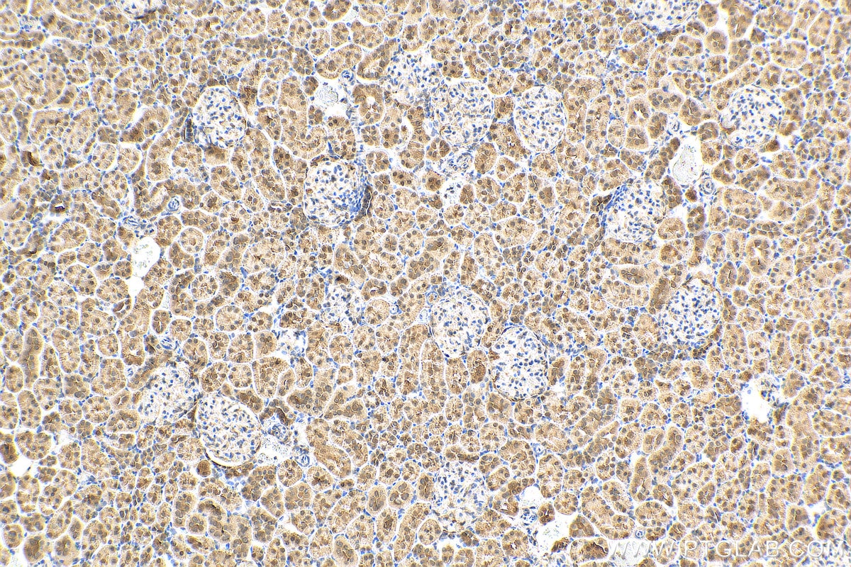 Immunohistochemistry (IHC) staining of rat kidney tissue using MRI1 Polyclonal antibody (19916-1-AP)