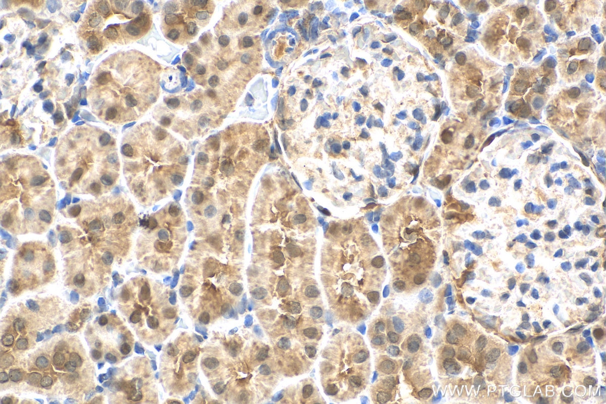 Immunohistochemistry (IHC) staining of rat kidney tissue using MRI1 Polyclonal antibody (19916-1-AP)