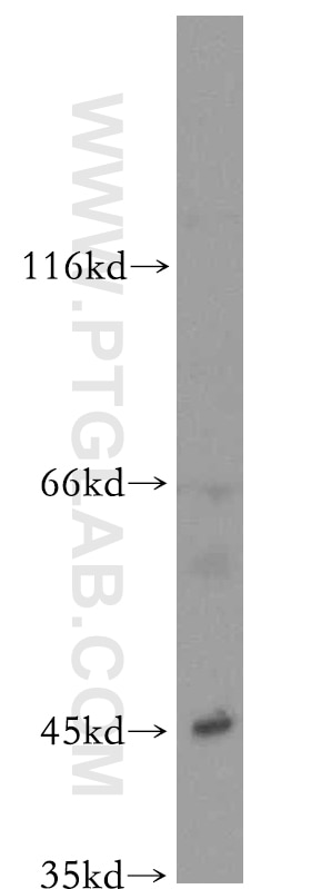 Western Blot (WB) analysis of HL-60 cells using MRI1 Polyclonal antibody (19916-1-AP)