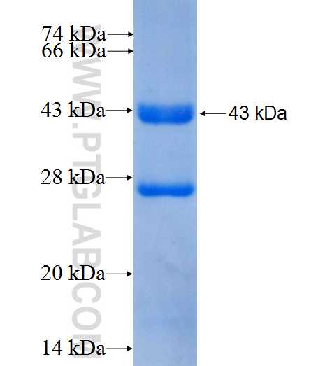 MRM1 fusion protein Ag9483 SDS-PAGE
