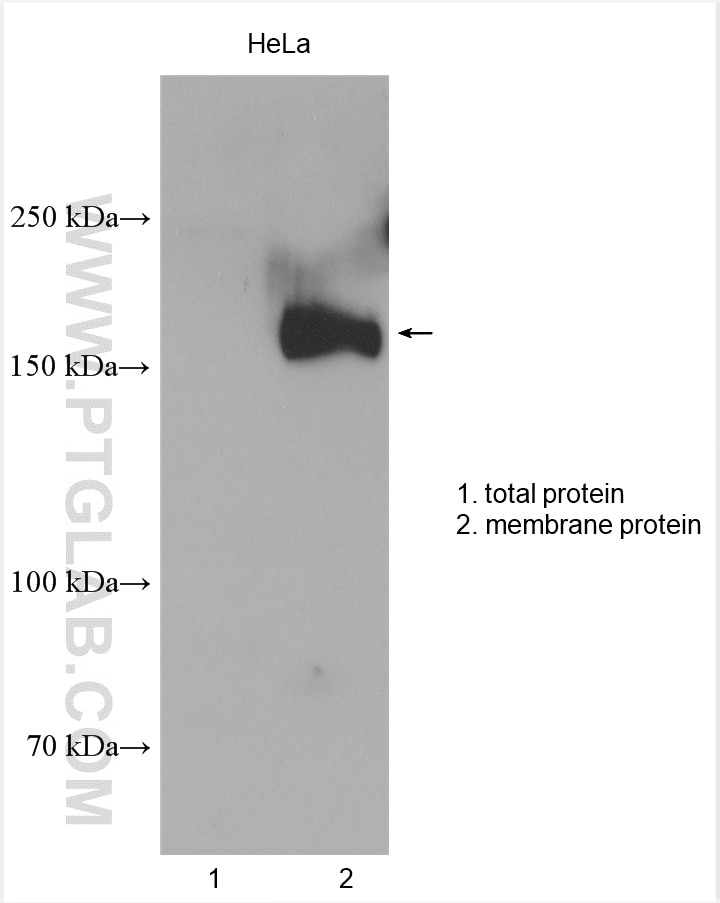 Western Blot (WB) analysis of various lysates using MRP1 Polyclonal antibody (27825-1-AP)
