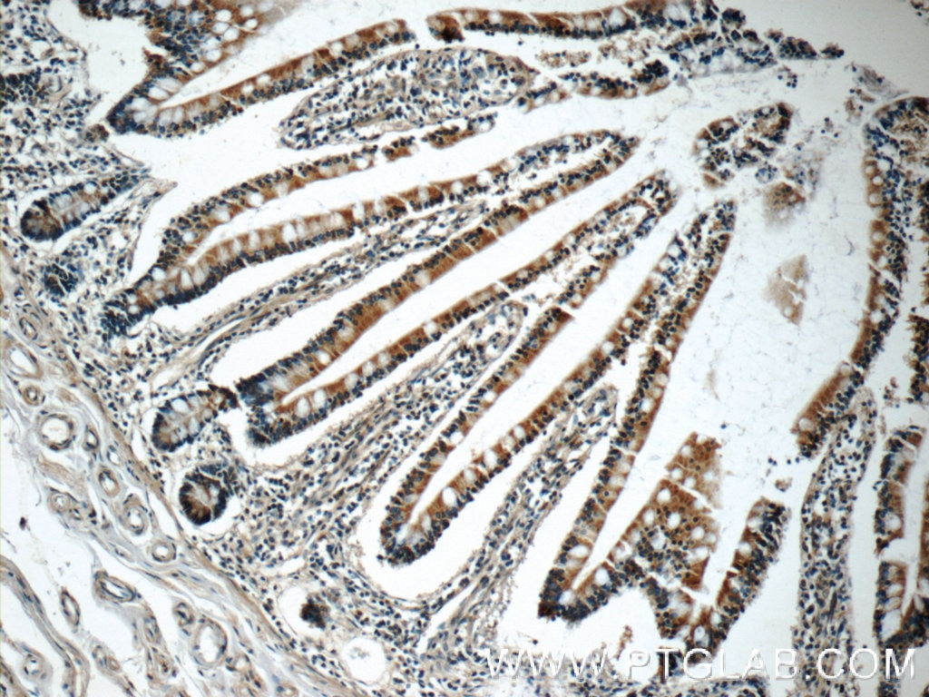 Immunohistochemistry (IHC) staining of human small intestine tissue using MRP2 Polyclonal antibody (24893-1-AP)