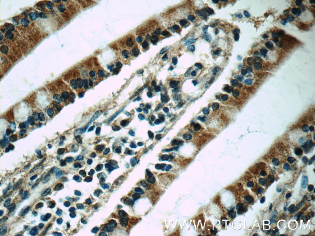 Immunohistochemistry (IHC) staining of human small intestine tissue using MRP2 Polyclonal antibody (24893-1-AP)