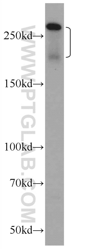 Western Blot (WB) analysis of HepG2 cells using MRP2 Polyclonal antibody (24893-1-AP)