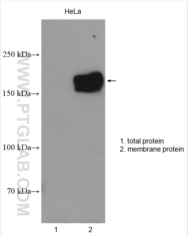 Western Blot (WB) analysis of HeLa cells using MRP4 Polyclonal antibody (27167-1-AP)