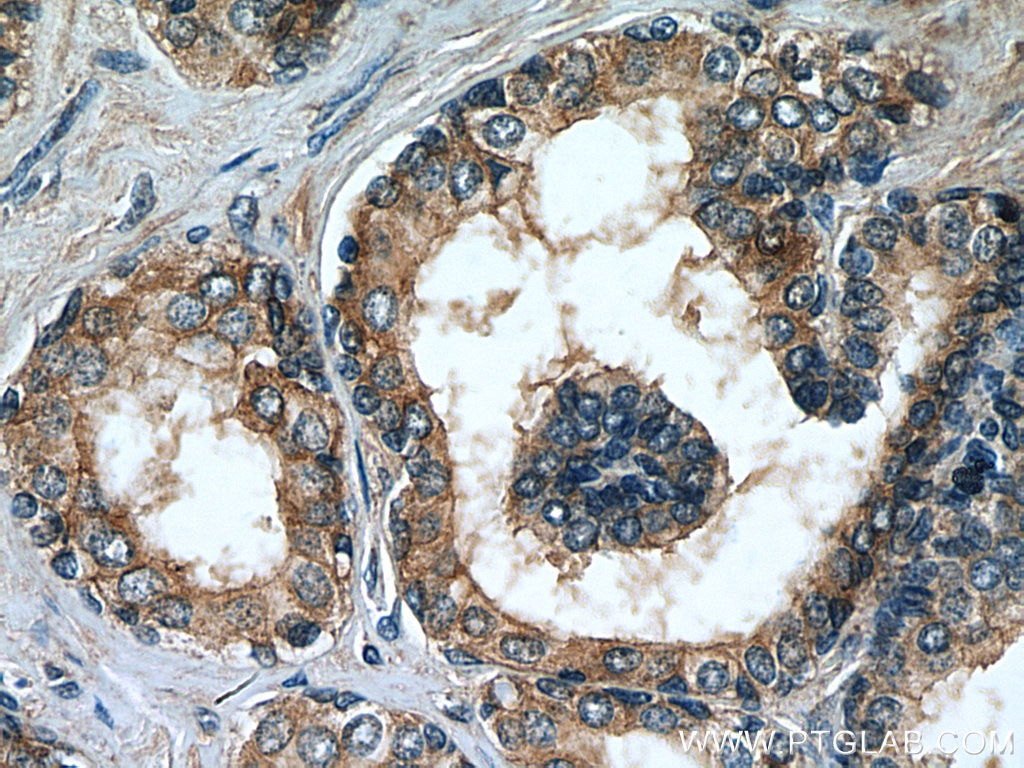 Immunohistochemistry (IHC) staining of human prostate hyperplasia tissue using MRP4 Monoclonal antibody (67230-1-Ig)