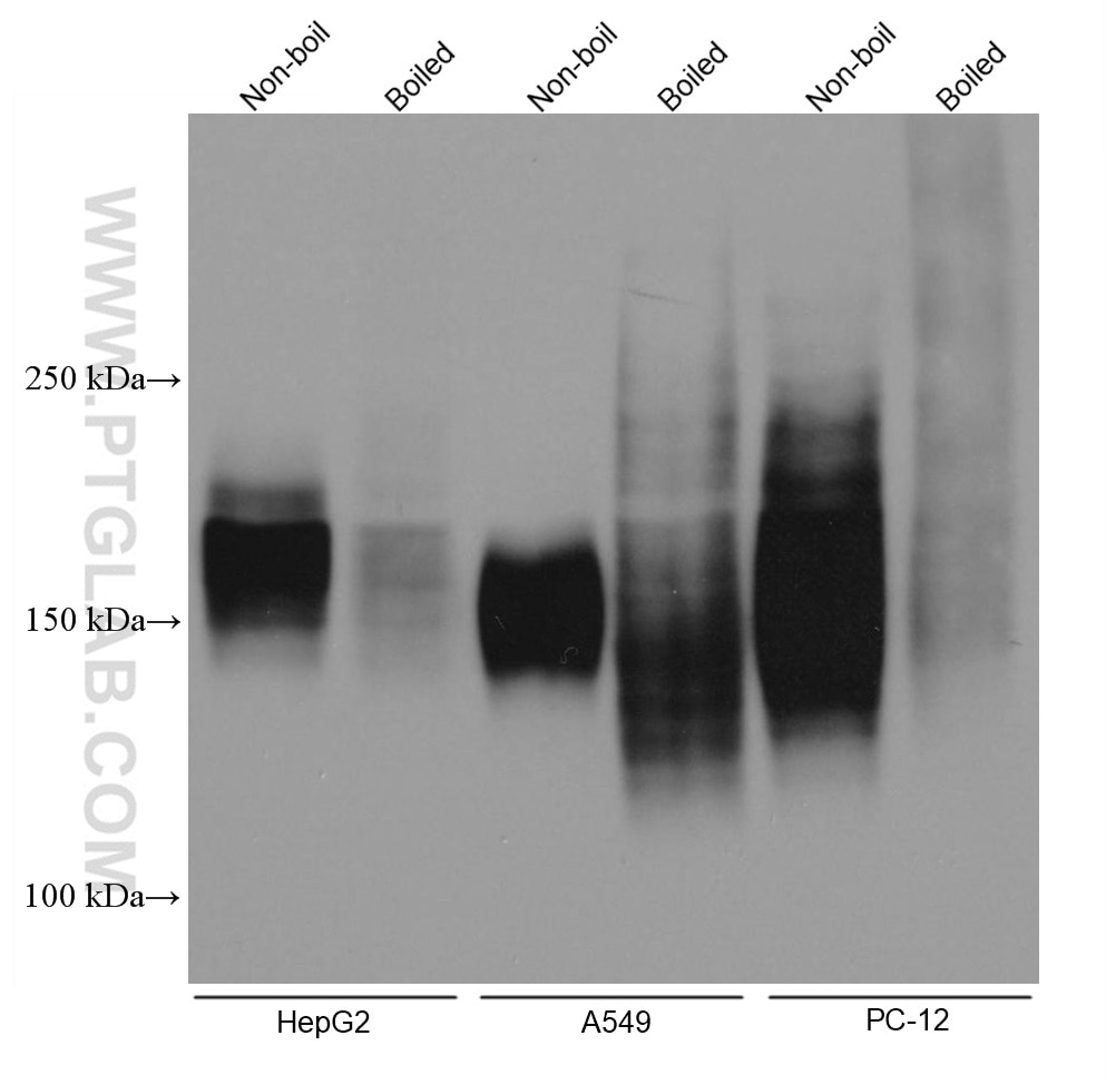 Western Blot (WB) analysis of various lysates using MRP4 Monoclonal antibody (67230-1-Ig)
