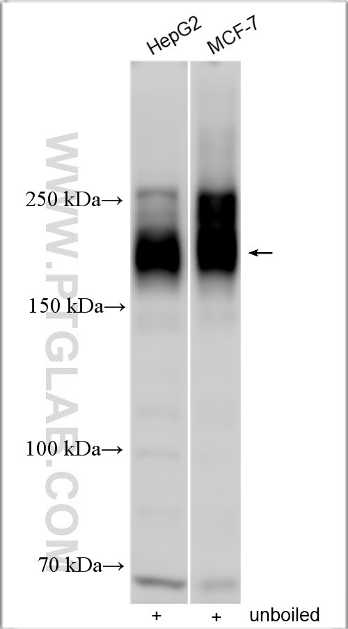 Western Blot (WB) analysis of various lysates using ABCC5 Polyclonal antibody (29792-1-AP)