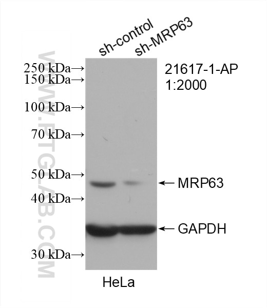 Western Blot (WB) analysis of HeLa cells using MRP63 Polyclonal antibody (21617-1-AP)