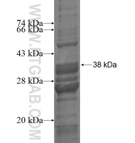 MRP63 fusion protein Ag7289 SDS-PAGE