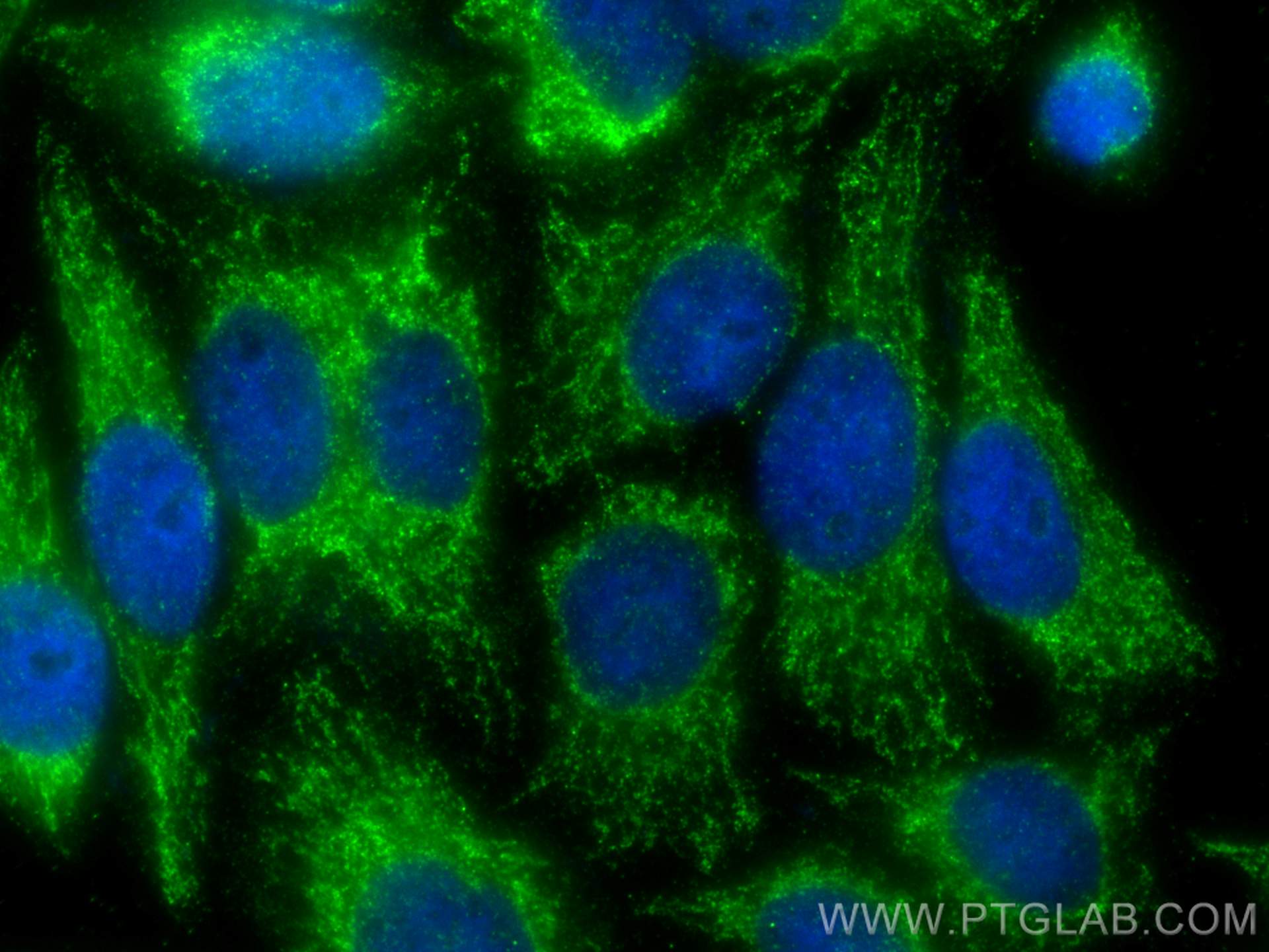 Immunofluorescence (IF) / fluorescent staining of HepG2 cells using MRPL10 Polyclonal antibody (16652-1-AP)