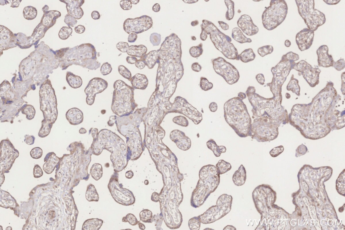 Immunohistochemistry (IHC) staining of human placenta tissue using MRPL10 Polyclonal antibody (16652-1-AP)