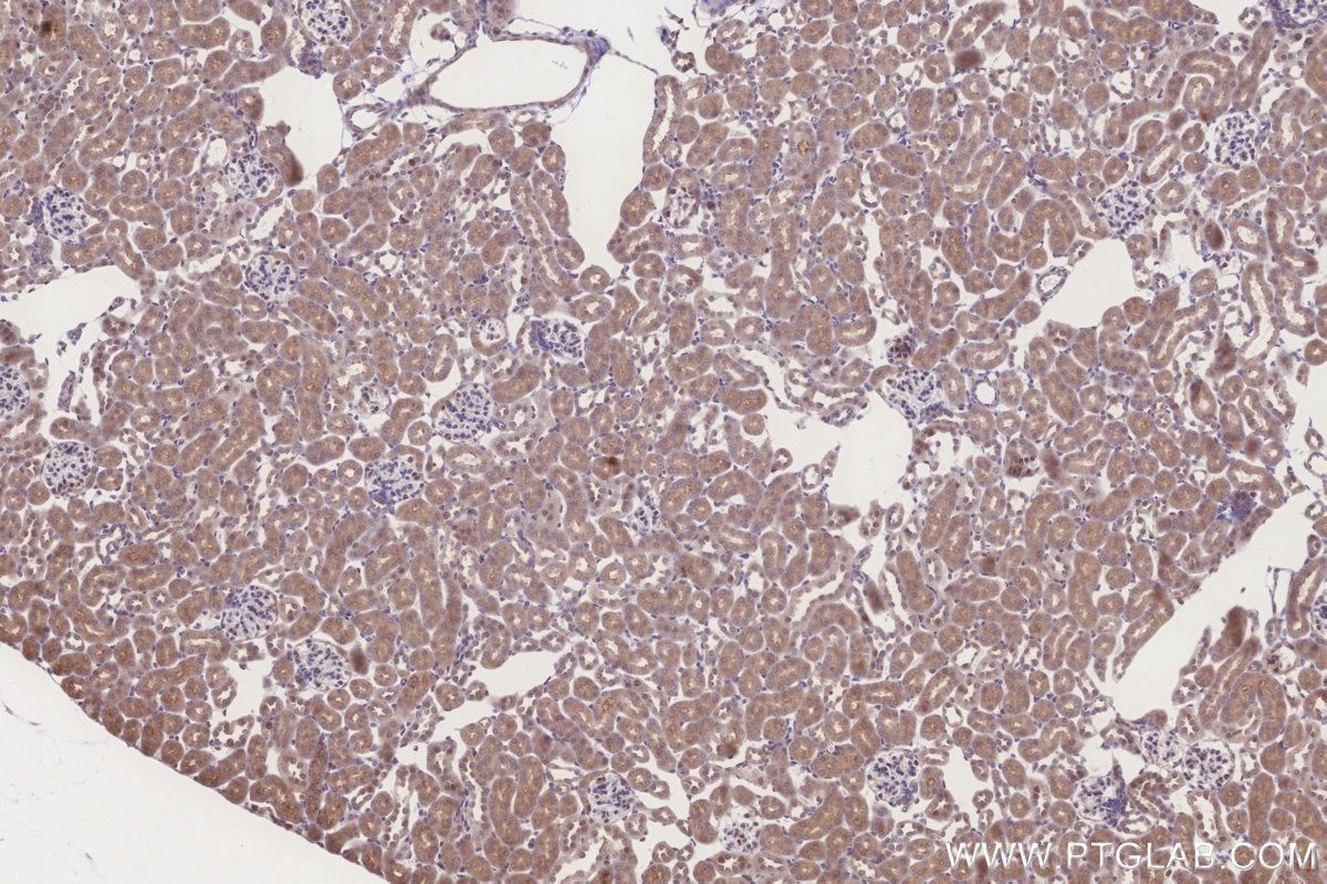 Immunohistochemistry (IHC) staining of mouse kidney tissue using MRPL10 Polyclonal antibody (16652-1-AP)