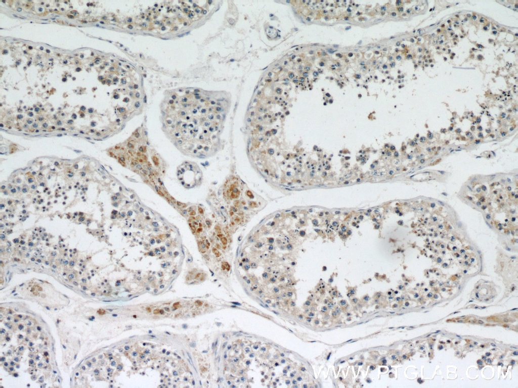 Immunohistochemistry (IHC) staining of human testis tissue using MRPL10 Polyclonal antibody (16652-1-AP)