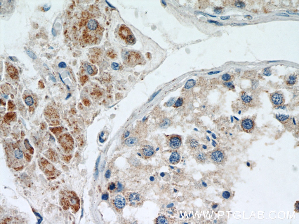 Immunohistochemistry (IHC) staining of human testis tissue using MRPL10 Polyclonal antibody (16652-1-AP)