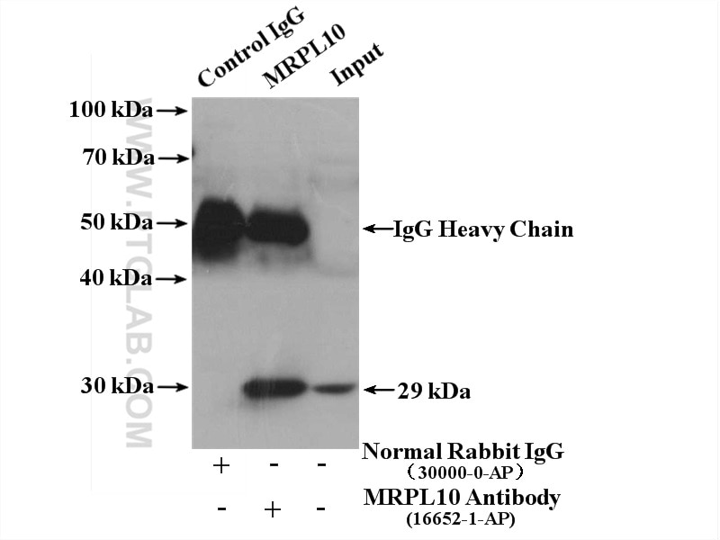 Immunoprecipitation (IP) experiment of mouse liver tissue using MRPL10 Polyclonal antibody (16652-1-AP)